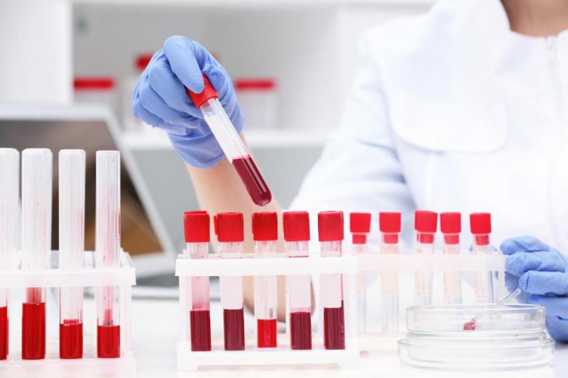 8 видов рака можно будет диагностировать с помощью анализа крови - обзор от магазина медтехники ME-D.RU