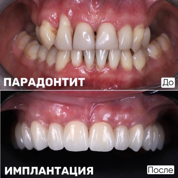 Красивая улыбка от доктора Георгия Захарова